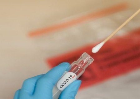 Estado registra mais 601 casos e 7 mortes por Covid