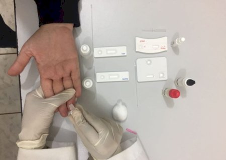UFGD fará testes rápidos de HIV, sífilis e hepatites no mês de abril