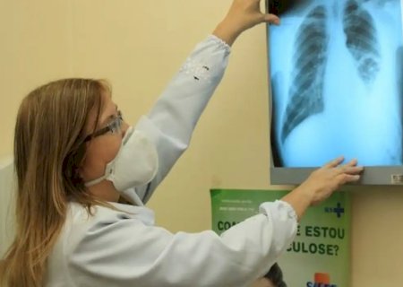 Dourados intensifica ações para o combate à Tuberculose