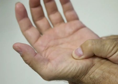 Lei define fibromialgia como deficiência em todo país a partir de 2026