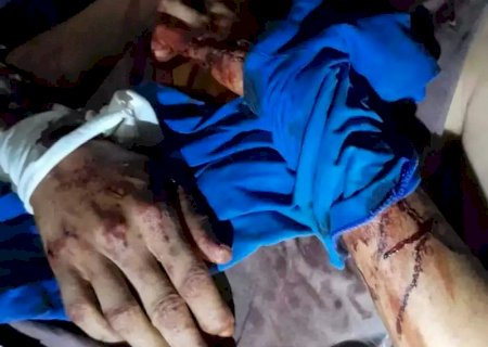 Peão é atacado por onça-pintada e fica gravemente ferido no Pantanal