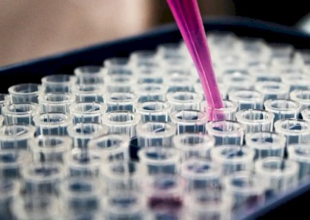 Estudo mostra que inflamação no cérebro pode ser chave do Alzheimer