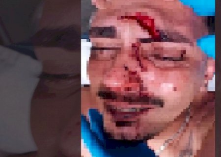 Jovem é atingido por garrafada na cabeça durante a Fejuna e acaba hospitalizado em Nova Andradina
